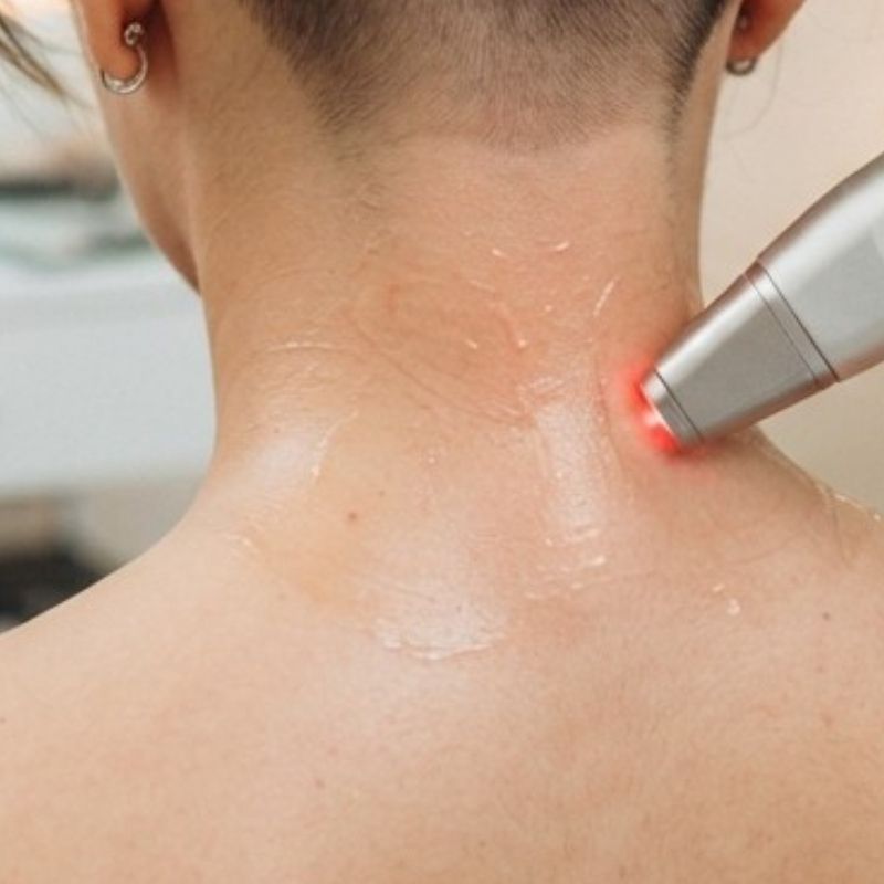 Cuello posterior