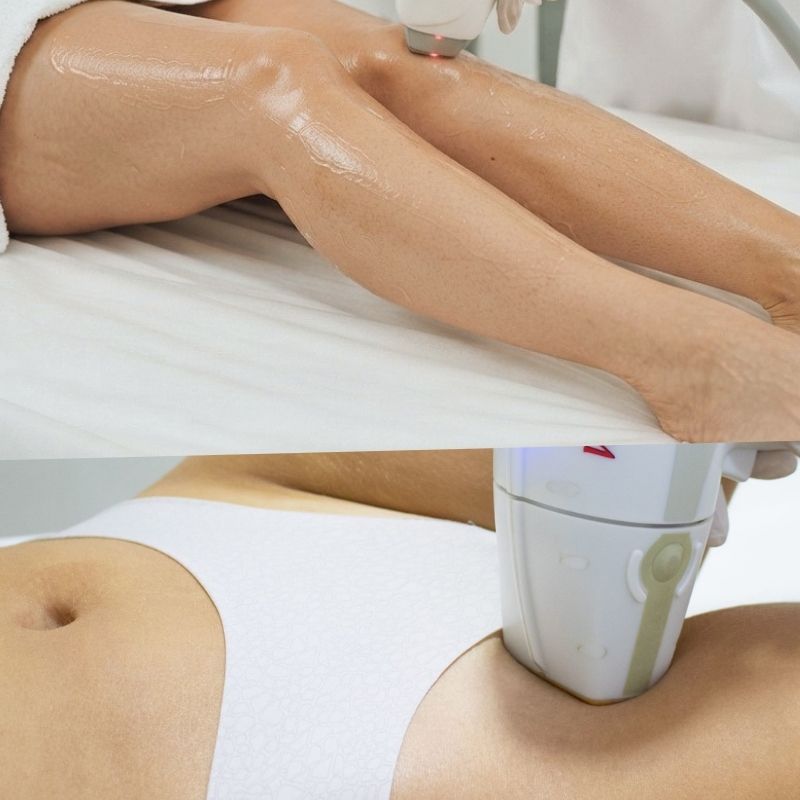 Piernas completas + Rebaje brasileño