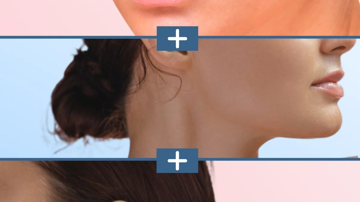 Estética Depilacion De Bozo Con Laser Labio Superior Laser En El