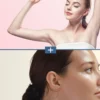 Collage of two beauty images: top shows a woman stretching with arms raised against a pink backdrop; bottom shows a close-up profile of a woman with clear skin, divided by a blue plus sign.
